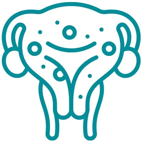 adénomyose icône