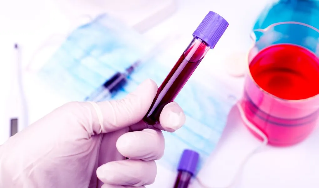 maladie de von Willebrand